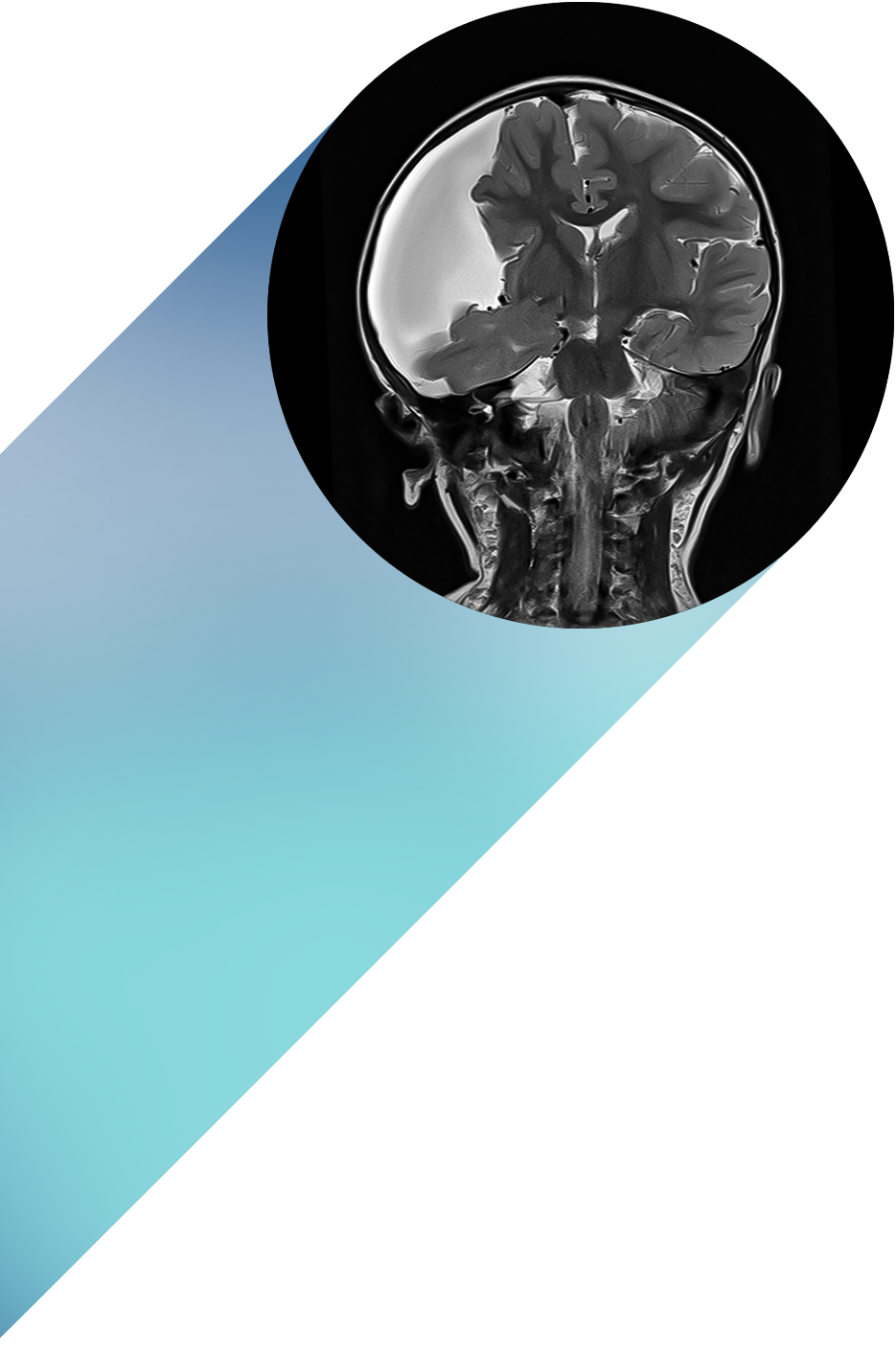 Resonancia Magnética
